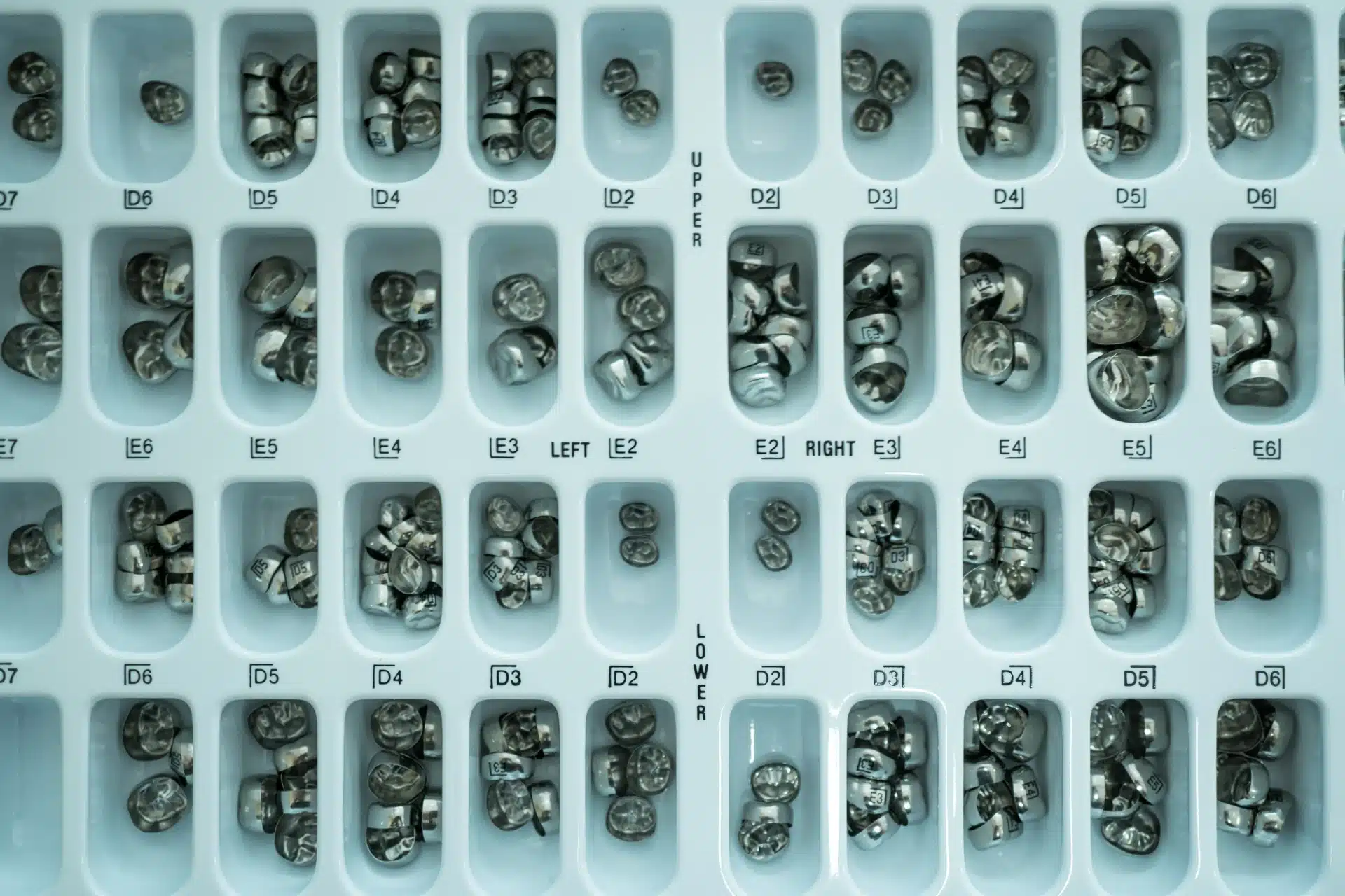 A variety of tooth amalgam fillings.
